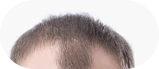 더 많은 피부 이야기 이미지