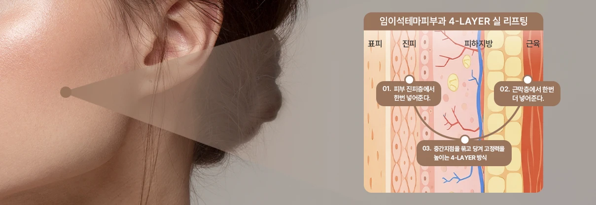 4개 층을 동시에 고정하는 진짜 리프팅
